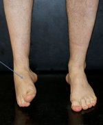 supinazione piede.JPG supinazione piede.JPG