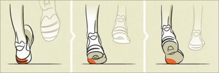 8img601x201-Underpronation-also-known-as-supination.jpg